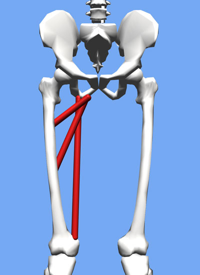 An image of the adductor magnus on an OpenSim model.