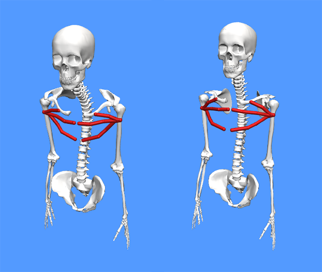 An image of two OpenSim models, one with posture issues and the other with an upright posture with the pectineus muscles highlighted